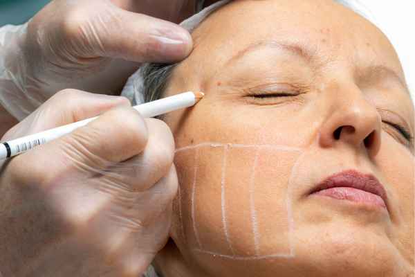 CryoPen: 5 Skin Concerns It May Be Used to Treat 4 What should you ask before having CryoPen treatment Warminster?