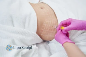 Are The Results From Aqualyx Permanent? 1 Do you want to know how long Aqualyx Warminster results last?