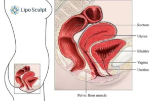 Treatment For A Leaky Bladder 2 How EM Chair treatment Warminster can help Leaky bladder issues. Read more now!